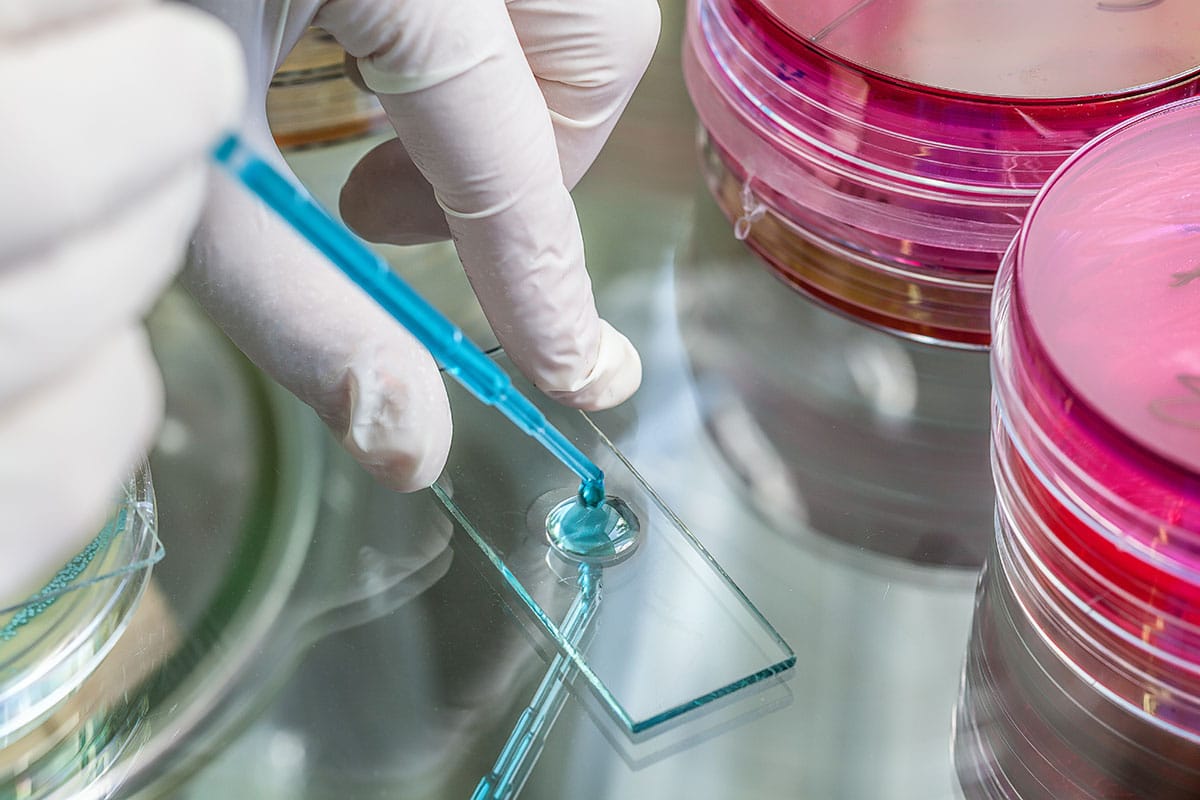 Analisi legionella condomini in laboratorio